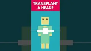 Can We Transplant a Human Head?