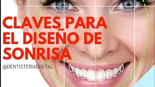 Claves para un DISEÑO DE SONRISA NATURAL -Parte 1