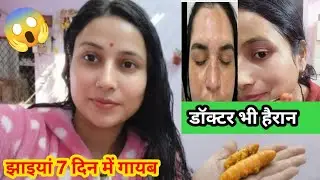 कसम खाकर कहती हूं😱सर्दियों में इस cream के साथ ये लेना झाइयां जड़ से खत्म हो जाएंगी#gorahonekatrika 