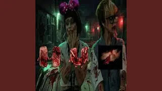 mhm 2