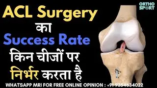 ACL Surgery का  Success Rate किन चीजों पर निर्भर करता है #aclsurgeryrecovery