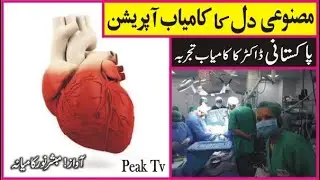 Artificial Heart | Medical Research | Karachi hospital | Peak Tv | Mubashar Noor