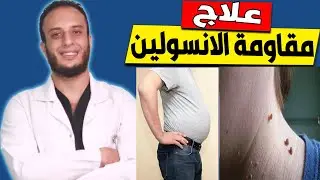 مقاومة الانسولين : افضل طريقة للتخلص من مقاومة الانسولين نهائيا