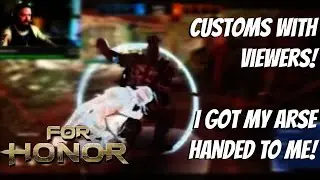 To celebrate 300 subscribers I GOT MY ARSE BEAT | For Honor
