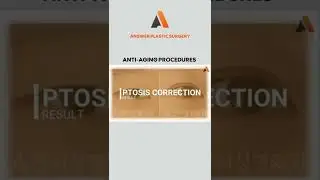 Anti-Aging Procedures | Answer Plastic Surgery #shorts #antiagingprocedures