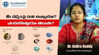 Skin Tags Removal in Telugu | పులిపిర్లకు కారణాలు & Treatments | Viswabharathi Hospital Kurnool