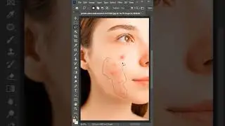Remove Pimples in 1 Click | Photoshop Tutorial for Beginners & Pros  #anasartistry #photoshop #adobe