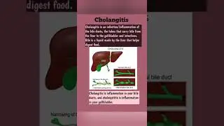 Cholangitis@FreeMedicalEducation-ld3sf#medical#nursing#mbbs#viralshortsvideo#youtubeviralshorts