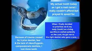 Dental Trauma & Personal Accountability for My FEAR & Failure to Prioritize My Teeth-GOD STILL HEARS