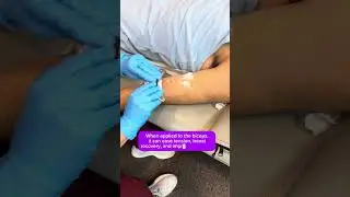 Marathon PT | IASTM on the Biceps