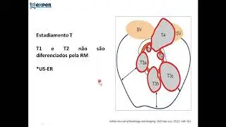 reto RM