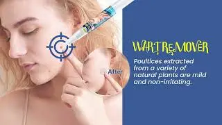 Natural Herbal Formula, Skin Tag & Wart Removal Pen