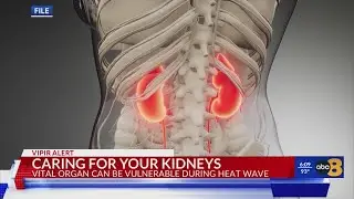 Heat wave warning: Protect your kidneys during extreme temperatures