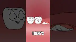 How Dentists Remove Wisdom Teeth Step by Step#animation #funny #shorts