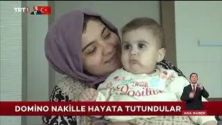 1 yaşında Ceyda 'nın Karaciğeri 7 Aylık Azat'a Domino Nakil