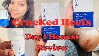Be Bodywise 30% Urea Foot Cream Roll On | Day 1 Honest Review | Cracked Heels Treatment