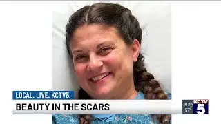 Dog&rsquo;s playful jump leads to life-saving cancer discovery