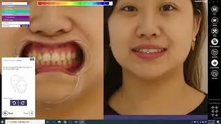 Digital Smile Design - Digital Dental Solutions