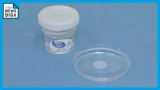 自分の細胞で培養の軟骨が膝の痛みを改善 変形性膝関節症に保険適用 3割負担で90万円に 患者は国内に推定1000万人  愛知･蒲郡市