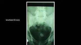 Interesting Urological Findings