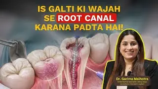 Is Galti Ki Wajah Se Root Canal Karana Padta Hai!