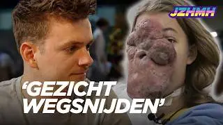 Esmee (14) heeft zwellingen in haar gezicht | Je Zal Het Maar Hebben