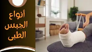 تجبيس الكسور- 3 أنواع الجبس الطبي وطرق المحافظة عليه