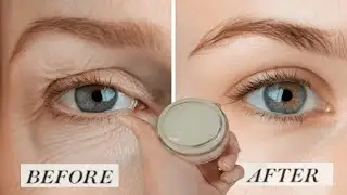 Natural Botox Effect at Home! Instantly Tighten Skin & Reduce Wrinkles Using 3 Simple Ingredients