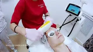 Лечение розацеа, акне, купероза, удаление сосудов в INSKIN.CLINIC, Санкт-Петербург