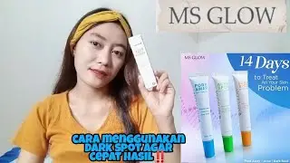 TIPS PEMAKAIAN MS GLOW DARK SPOT HASIL MAKSIMAL| mustika dewi