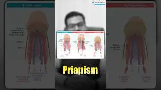Priapism- Prolonged painful erection?🚨