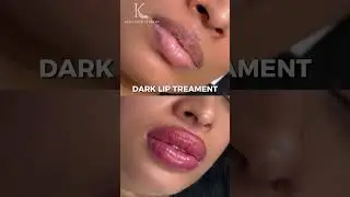 Dark lip treatment isn&rsquo;t about covering