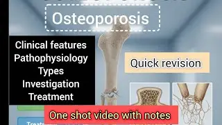 Osteoporosis teaching #osteoporosis #bones #ayush #ayurveda #exampreparation #education #bone #yt
