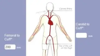 PWV Demonstration