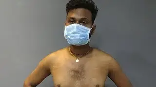 🔴 Live Gynecomastia Surgery Planning | Delhi Lakhnow Patna Ranchi Noida Dehradun Agra Aligarh Nagpur
