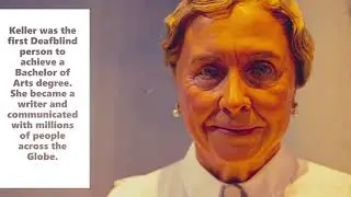 5 Famous Deaf & Dumb people who changed the narrative | Bloom India