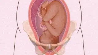 Types of Female Pelvis Explained | Essential Guide for Nurses, Midwives & Doctors