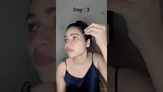 The ordinary Alpha Arbutin Serum Review | 7 Days challenge | #shorts #challenge #bright #ytshorts