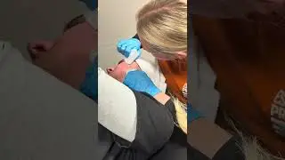 Restore Peel by Epionce 