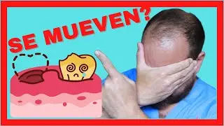 Dientes FLOJOS en Adultos 💀 [ACABA MAL si te Descuidas] 3 Señales de ALERTA!