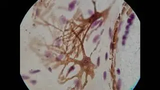 frog melanocytes