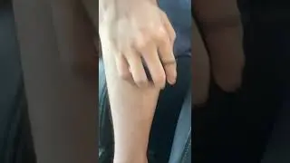 Upgraded Crystal Hair Removal Magic