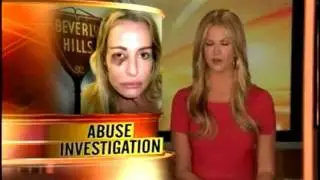 Battered Beverly Hills Housewife