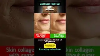 Why Quit Sugar? #sugar #health #diet #dietitian #weightloss #healthtips #ytshorts #viral #fyp #trend