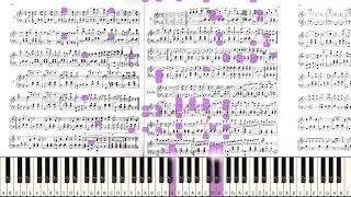 Johann Strauss II: Artist's Life, Op. 316 [Sight-read]
