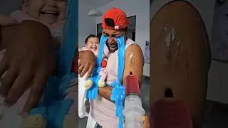 Baby cute Injection 😰😭💉🩸#funny #comedy #funnyvideo #funnymoments #injection #injection_funny