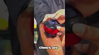 Electric Hijama Cup Machine|Review