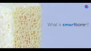 What is Smartbone?