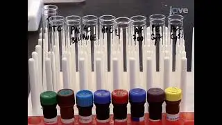 Peptide MHC Tetramer based Enrichment of Epitope specific T cells