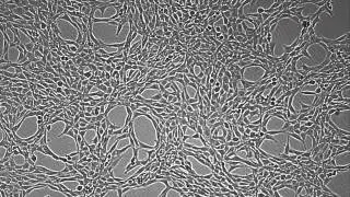 JuLI Br Live Cell Analyzer NIH 3T3 cells Growth 70 hrs